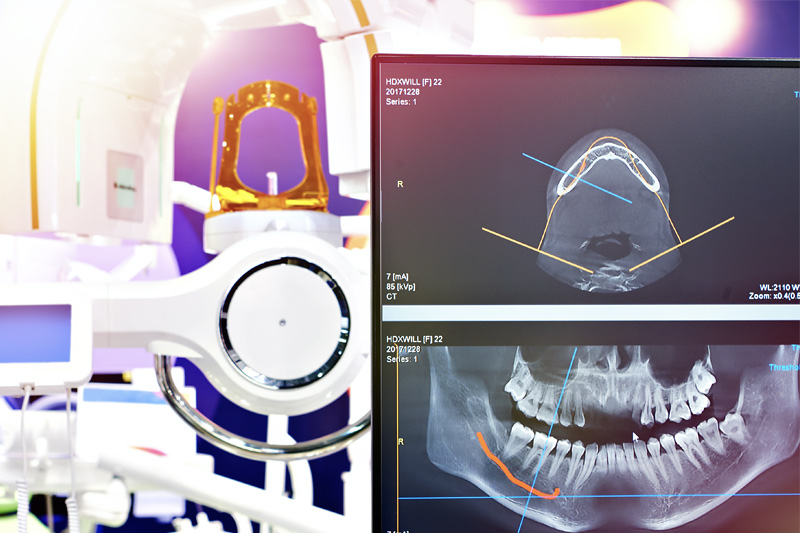 Digital X-Rays in Bel Air
